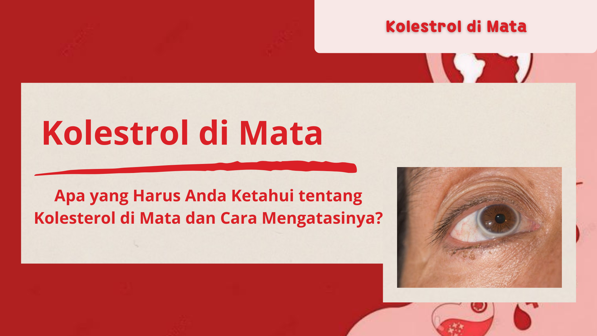 Kolestrol di Mata