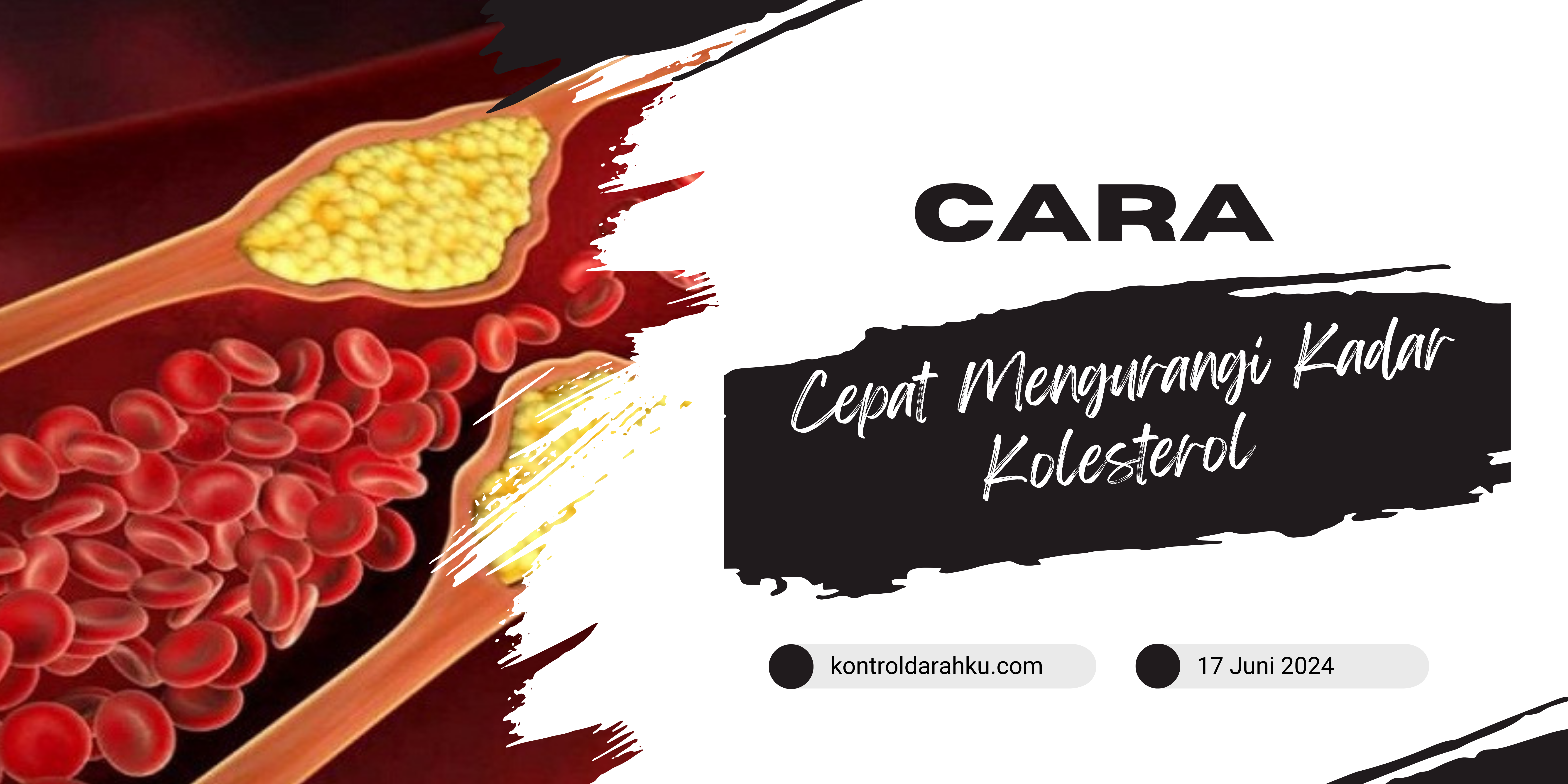 Cara Cepat Mengurangi Kadar Kolesterol