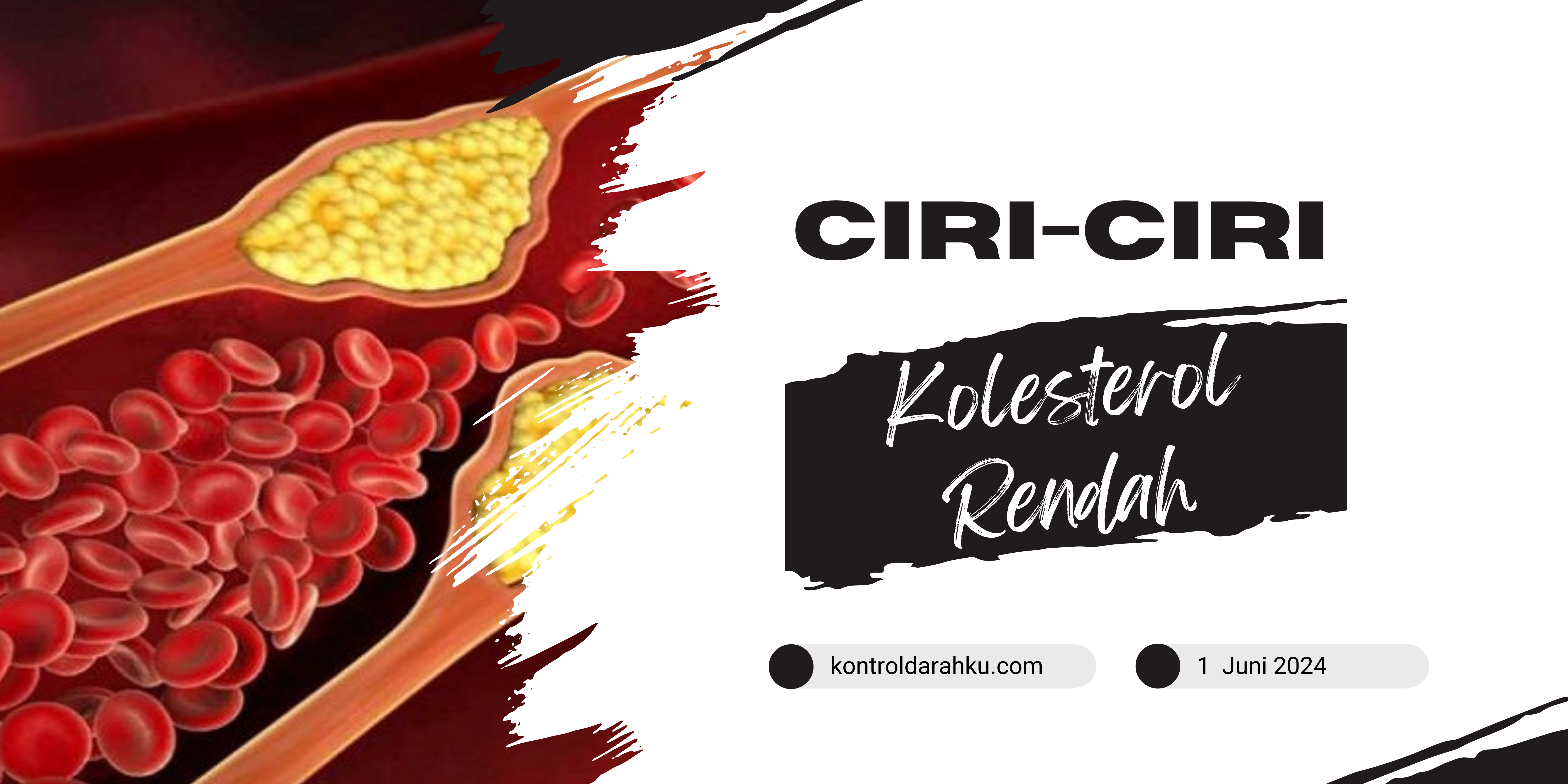 Ciri-Ciri Kolesterol Rendah