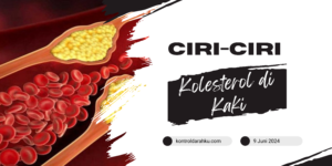 Ciri-Ciri Kolesterol di Kaki