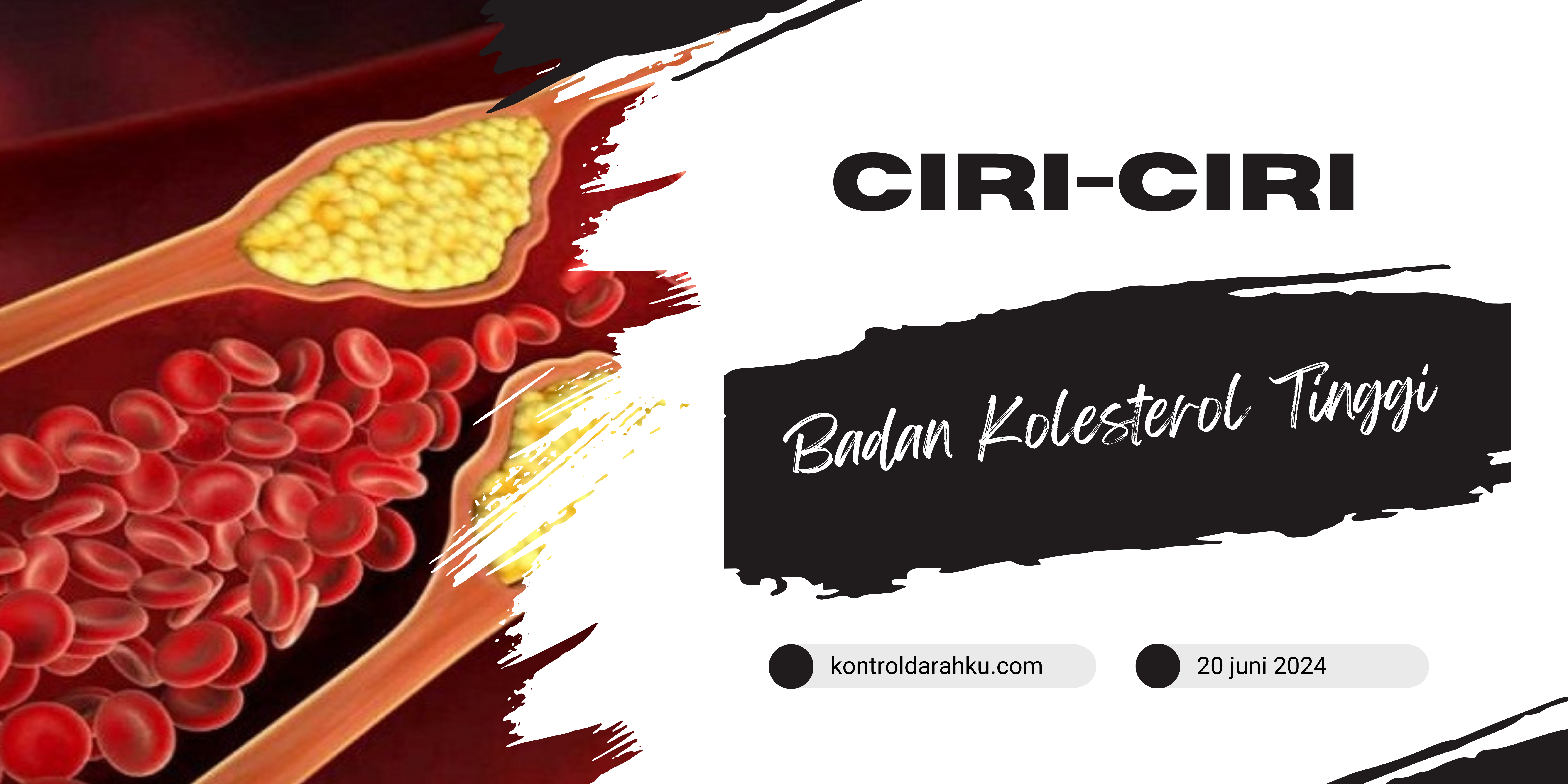 Ciri-Ciri Badan Kolesterol Tinggi