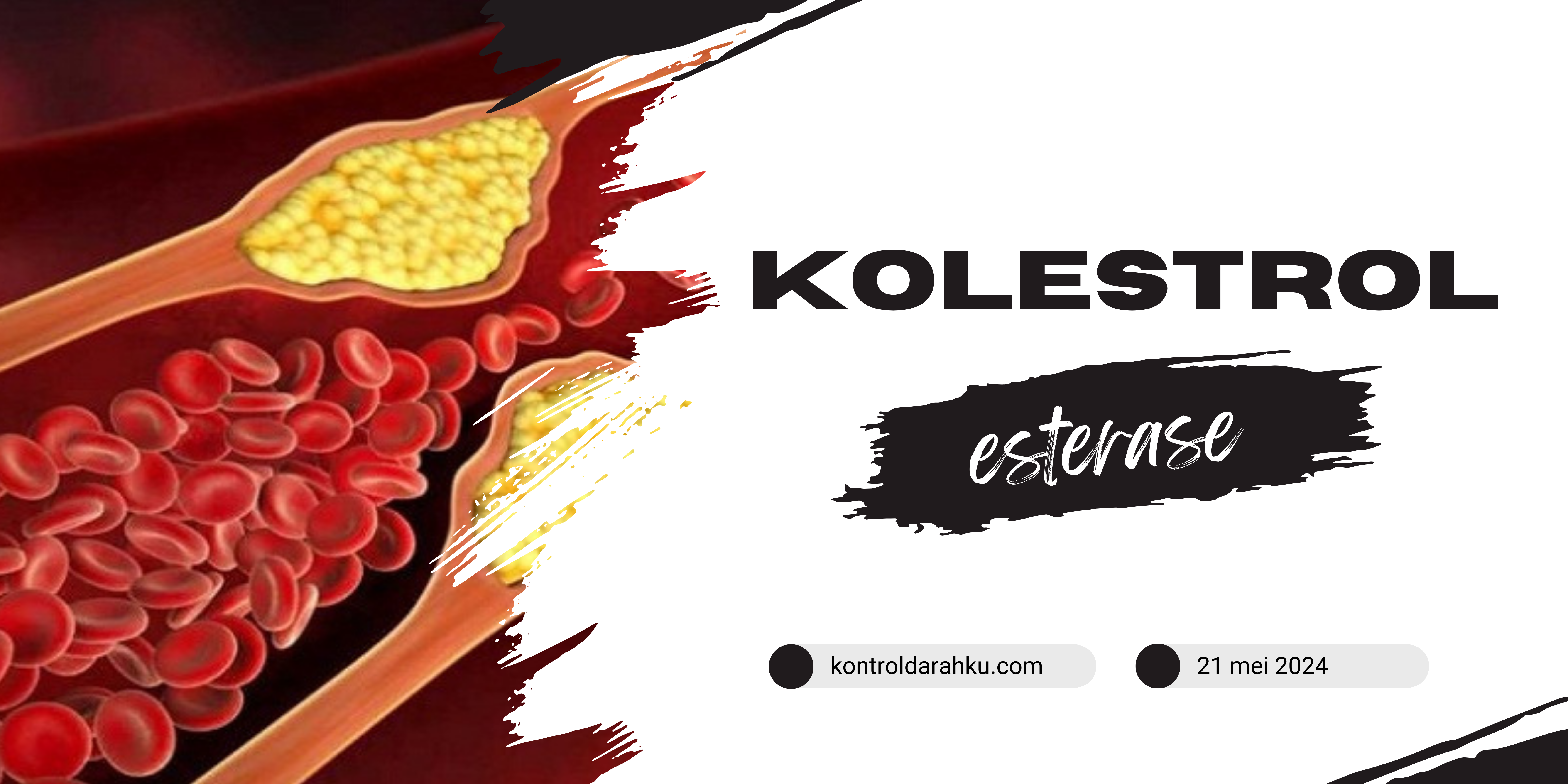 Kolesterol Esterase