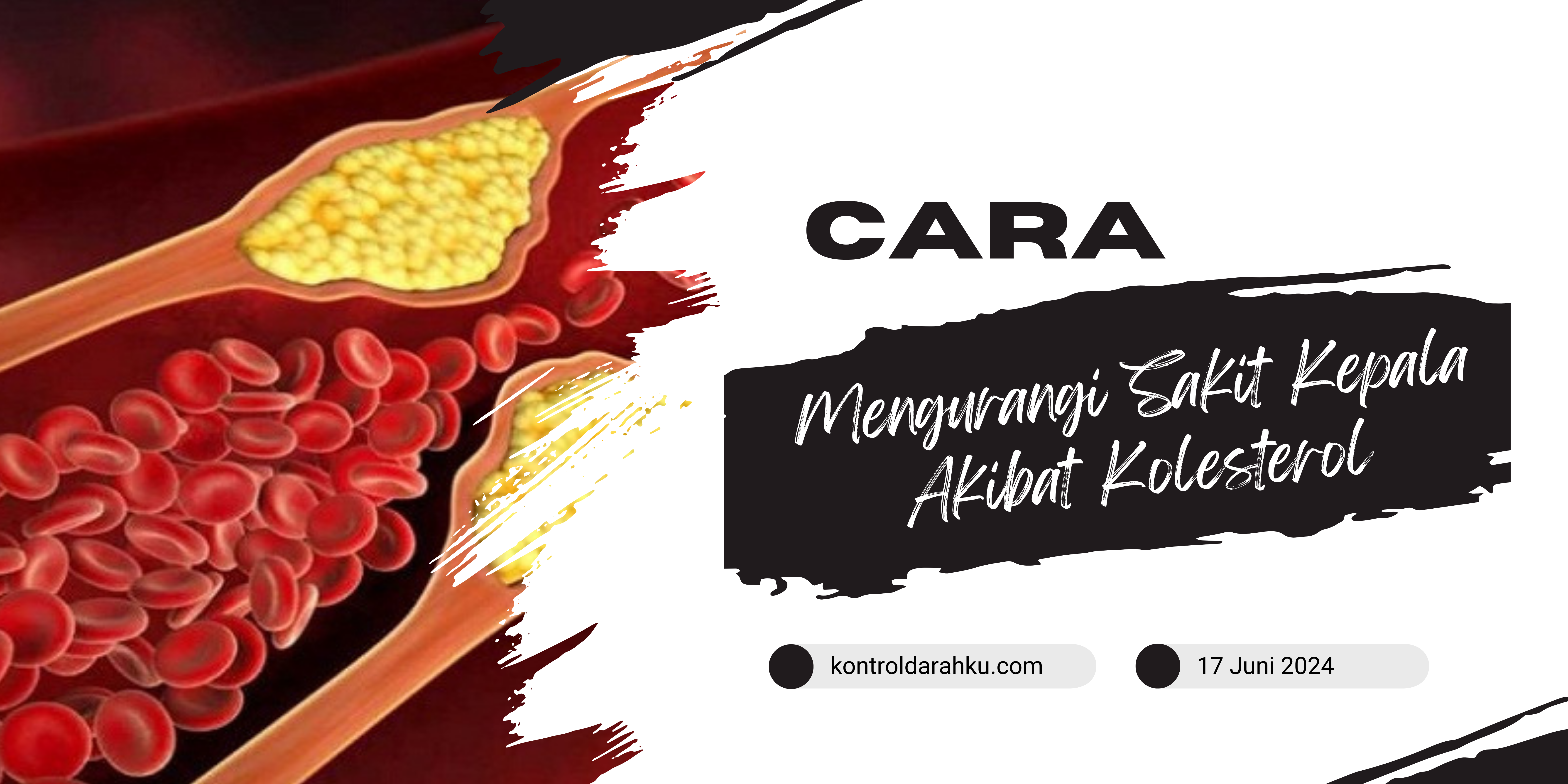 Cara Mengurangi Sakit Kepala Akibat Kolesterol