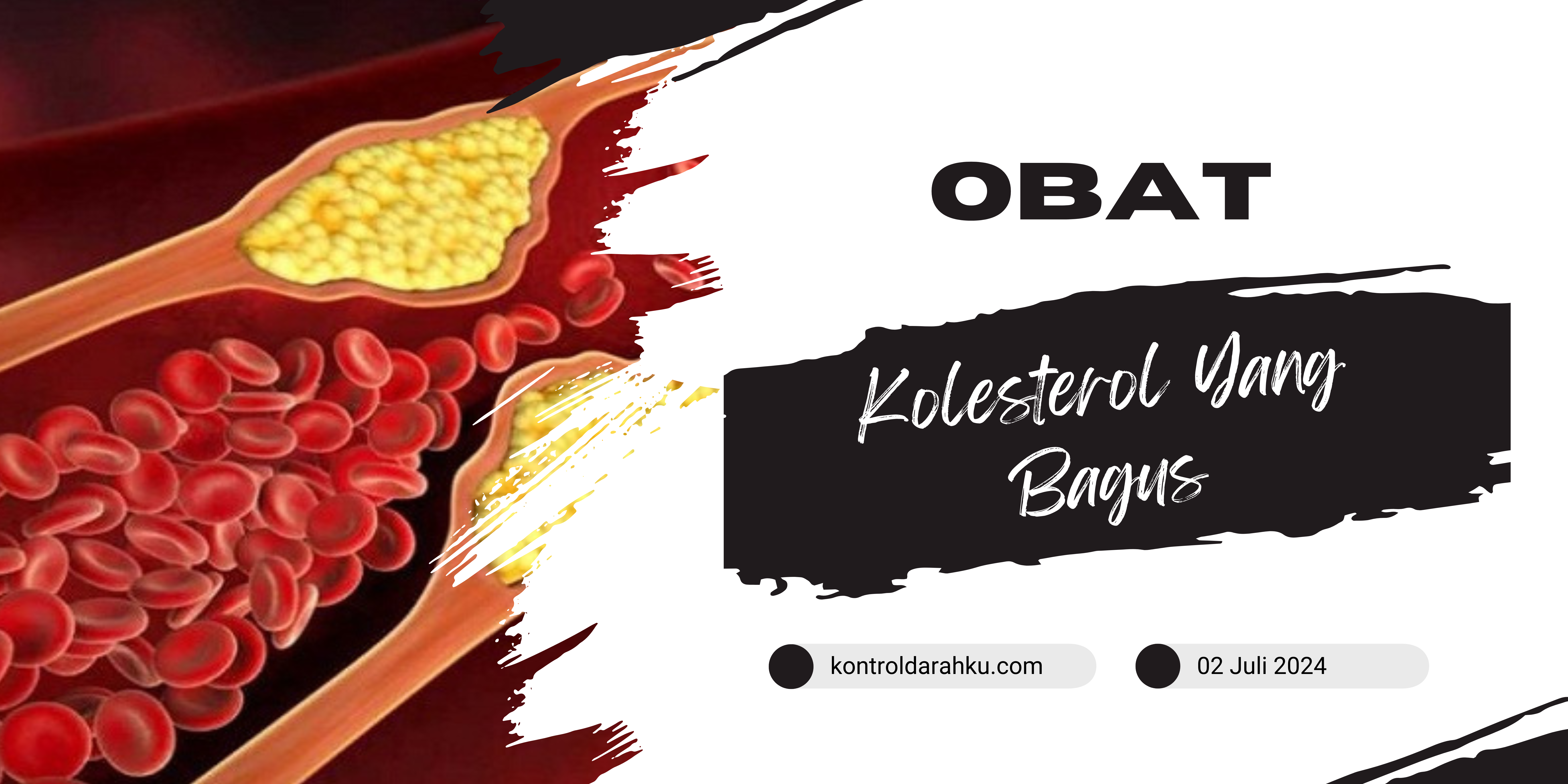 Obat Kolesterol Yang Bagus