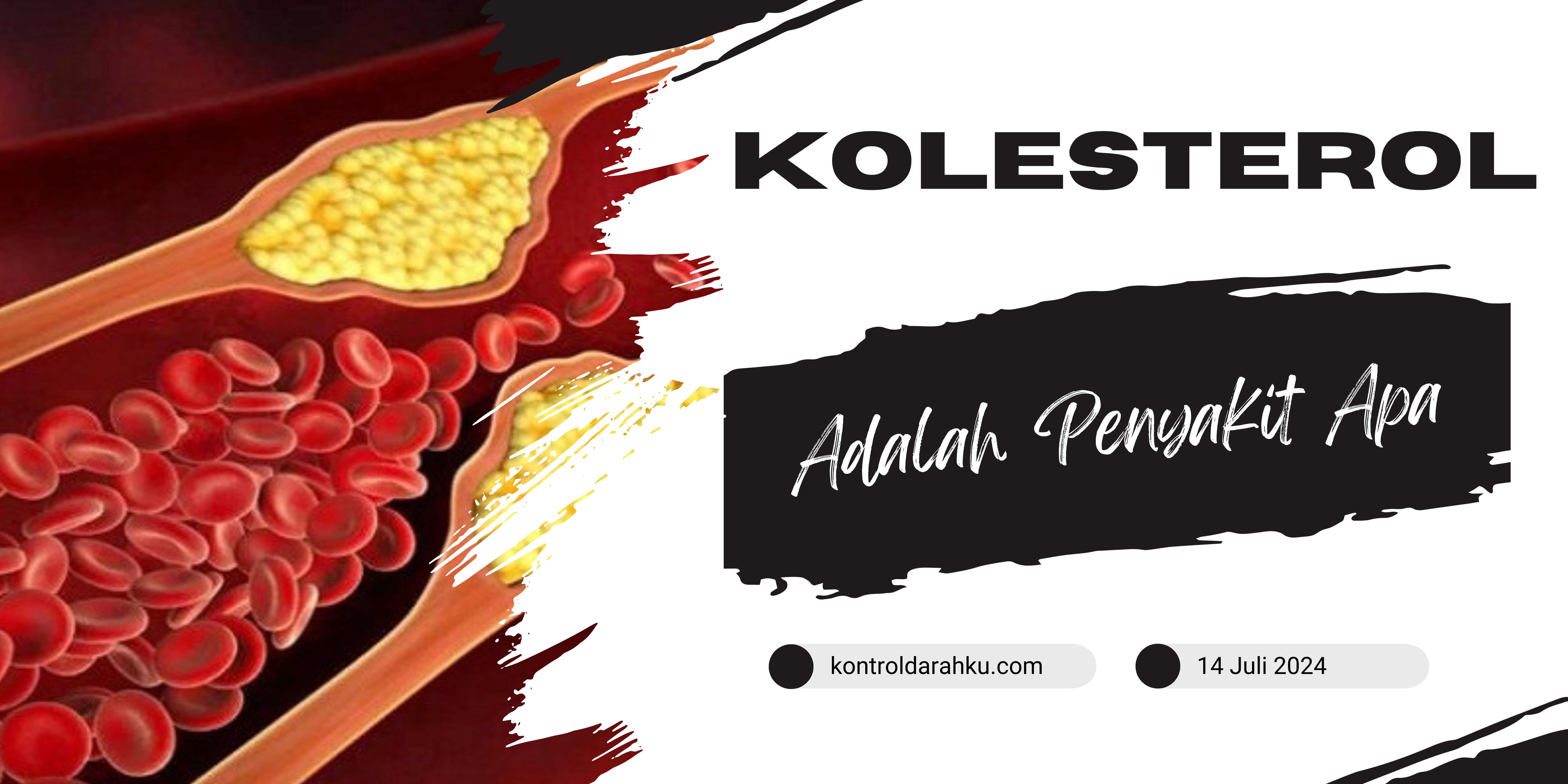 Kolesterol Adalah Penyakit Apa