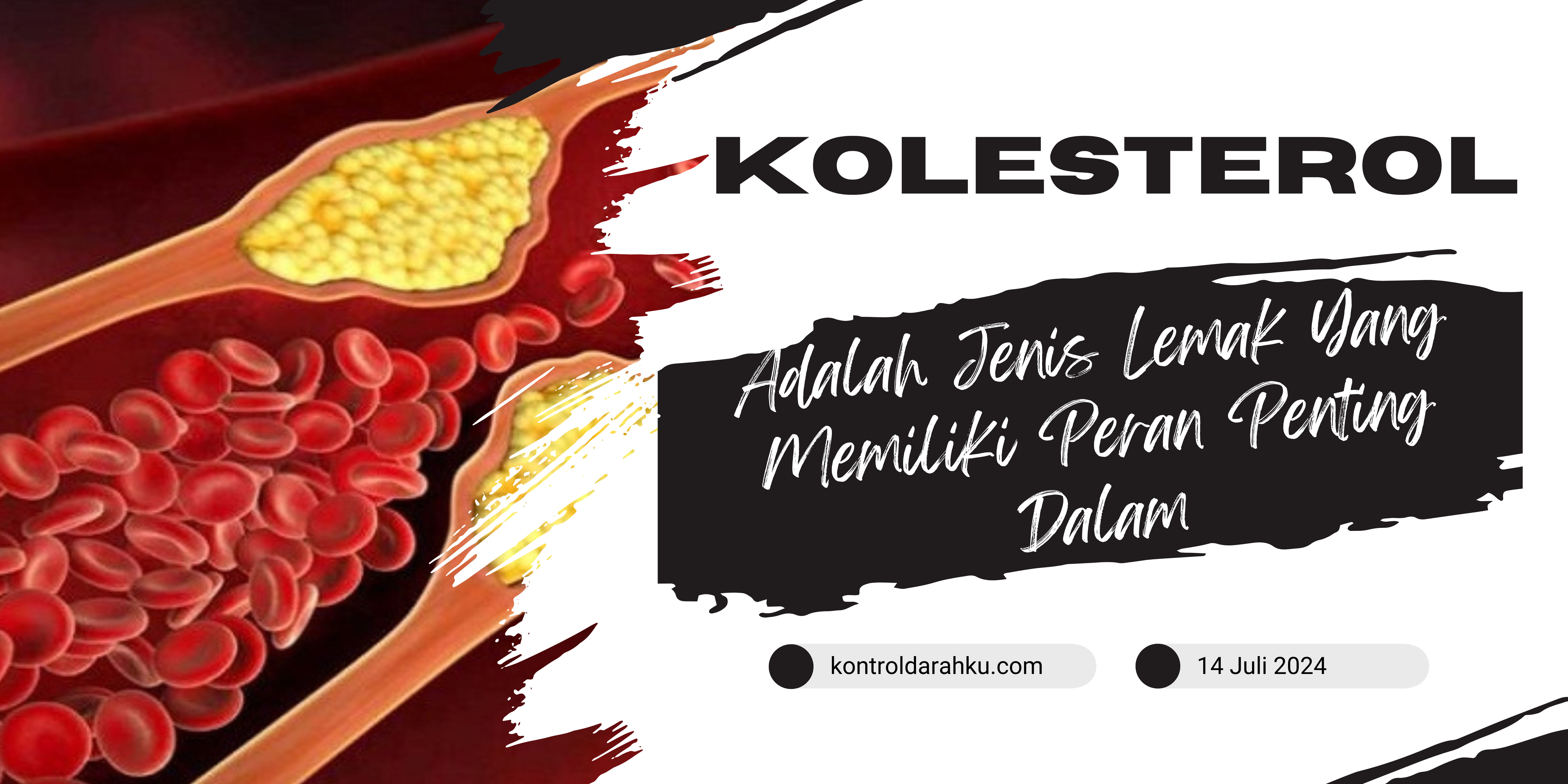 Kolesterol Adalah Jenis Lemak Yang Memiliki Peran Penting Dalam