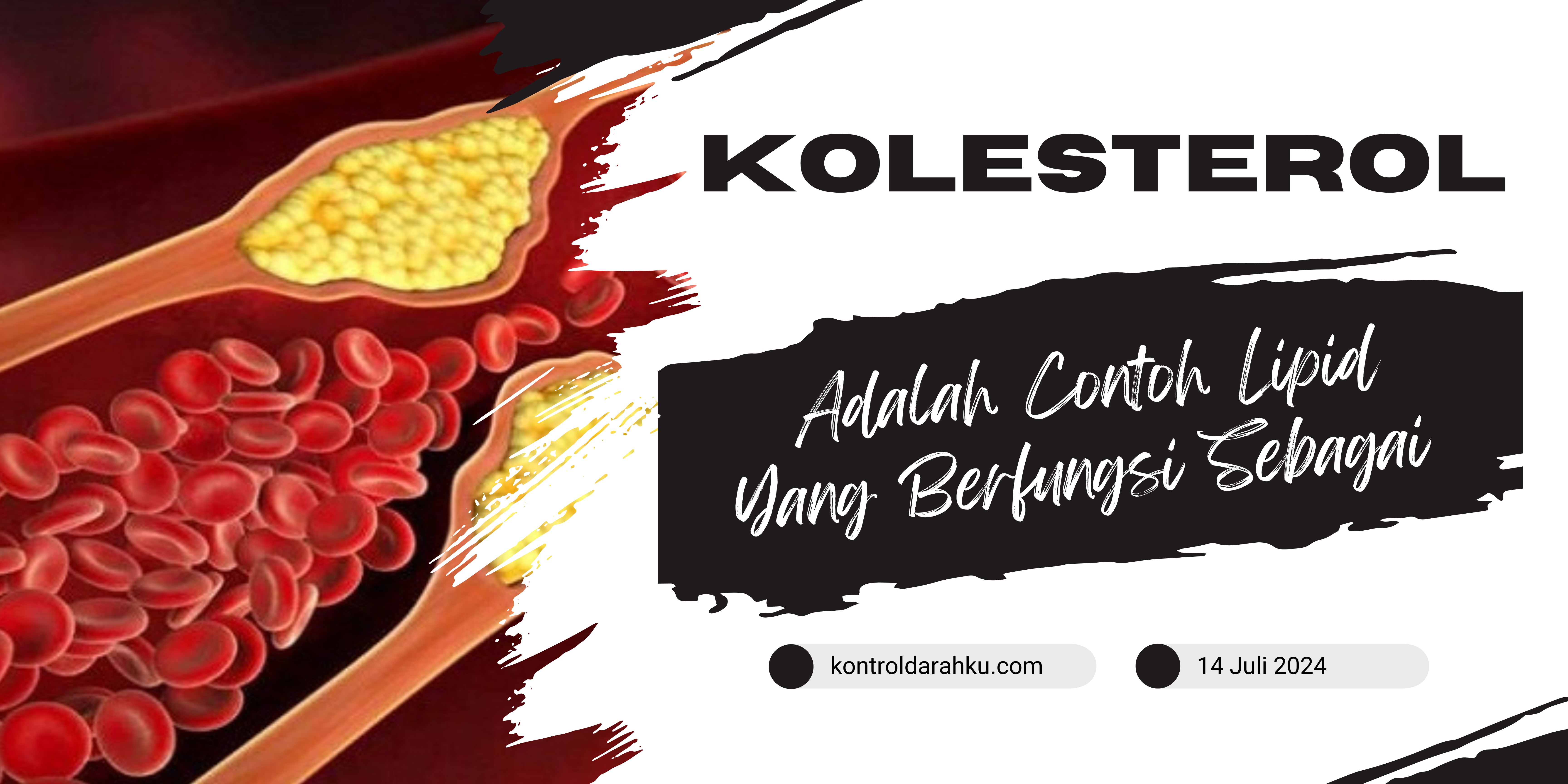 Kolesterol Adalah Contoh Lipid Yang Berfungsi Sebagai