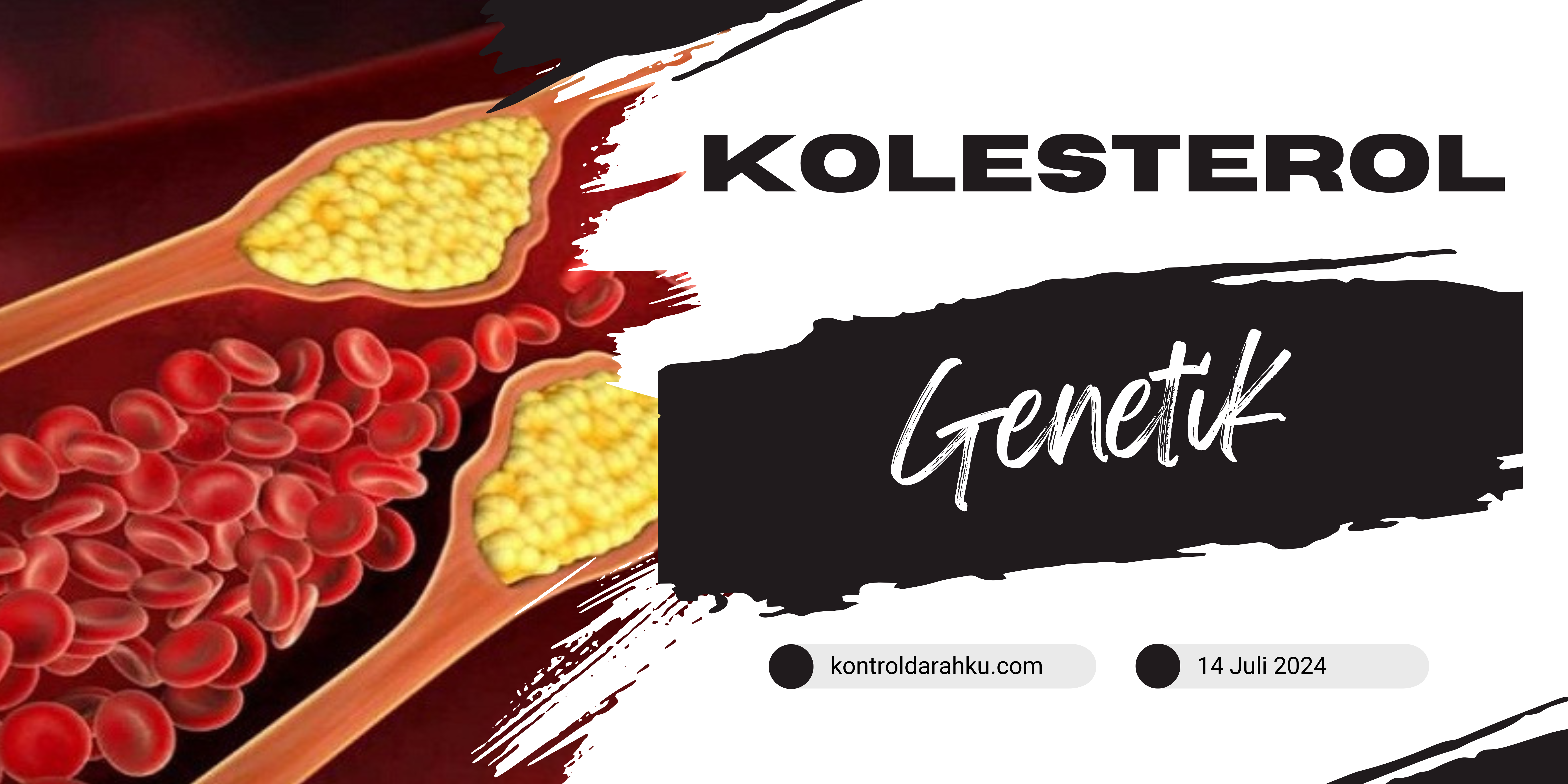 Kolesterol Genetik