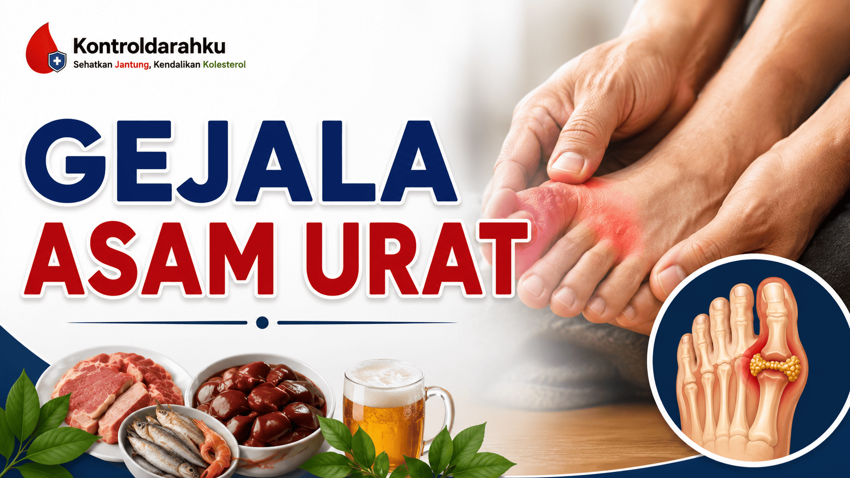 gejala asam urat