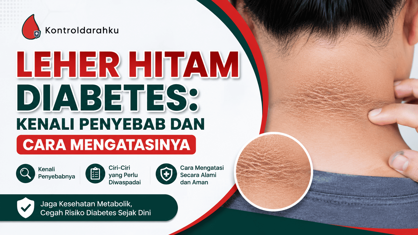 leher hitam diabetes