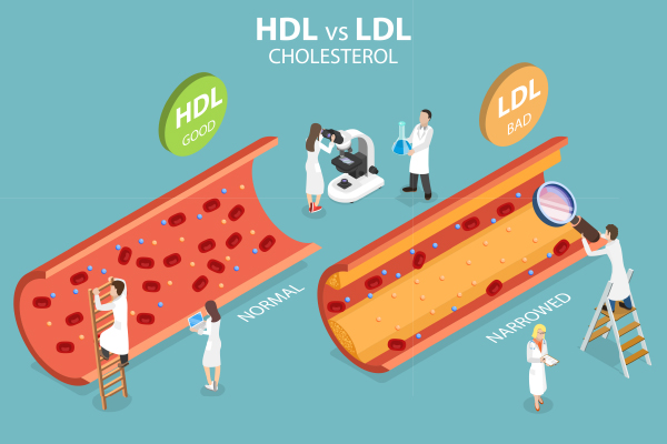 Fungsi LDL dalam Tubuh