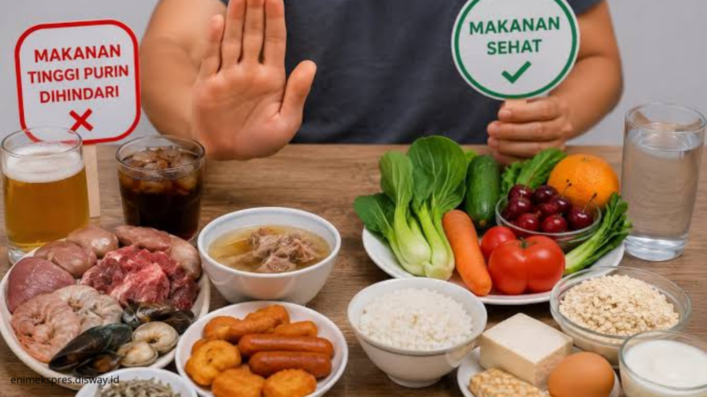 Penyebab Asam Urat yang Sering Diabaikan, Apakah Pola Makan Salah Satunya?