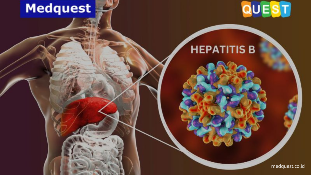 Kenali Gejala, Penularan, dan Pencegahannya: Apa Itu Penyakit Hepatitis B?