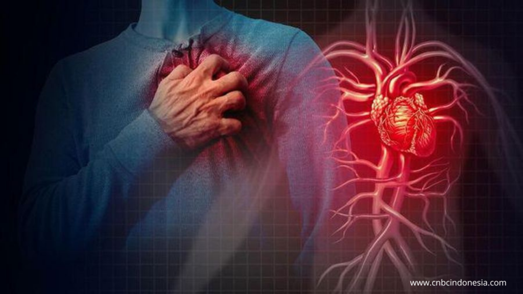 Efek dari Kolesterol Tinggi pada Jantung dan Pembuluh Darah