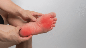 Kolesterol Tinggi di Kaki? Kenali Tanda Gangguan Aliran Darah